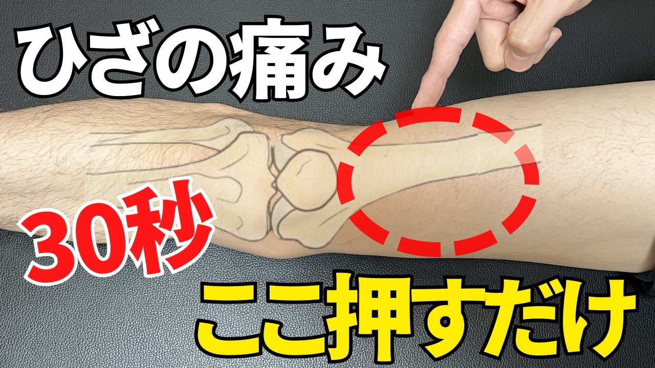 ひざの痛みはヒアルロン酸注射、筋トレよりもこれで消える。30秒ここを押してください。