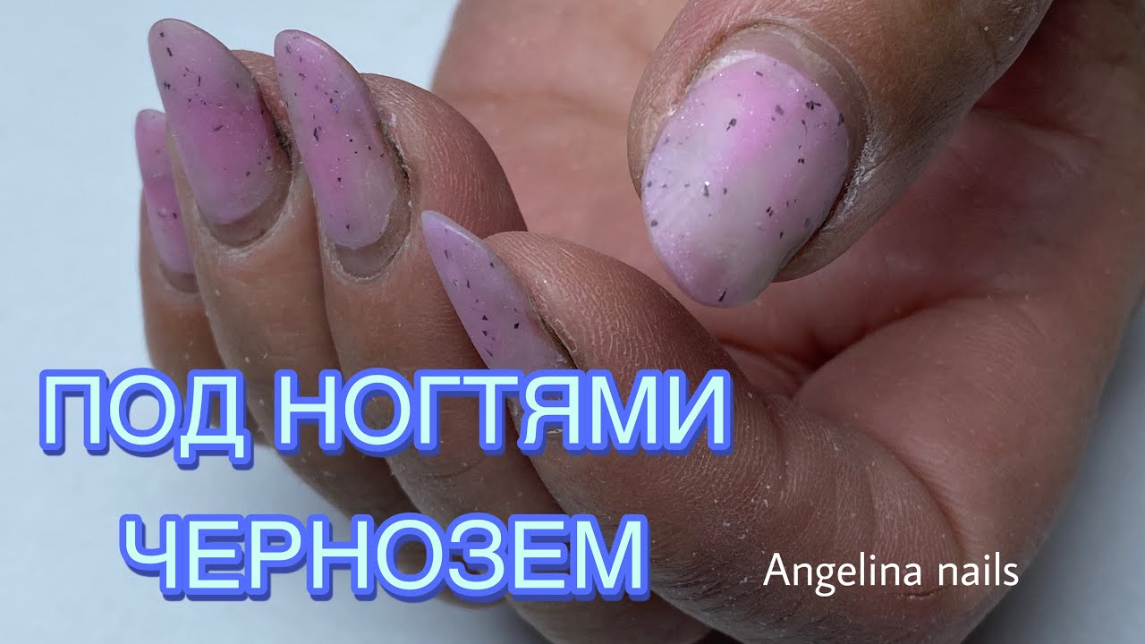 СЛОЖНАЯ КОРРЕКЦИЯ НОГТЕЙ / ЗЕМЛЯ ПОД НОГТЯМИ / СЛАЙДЕРЫ ОТВАЛИВАЮТСЯ ВСЕГДА / БЫСТРЫЙ ДИЗАЙН НОГТЕЙ