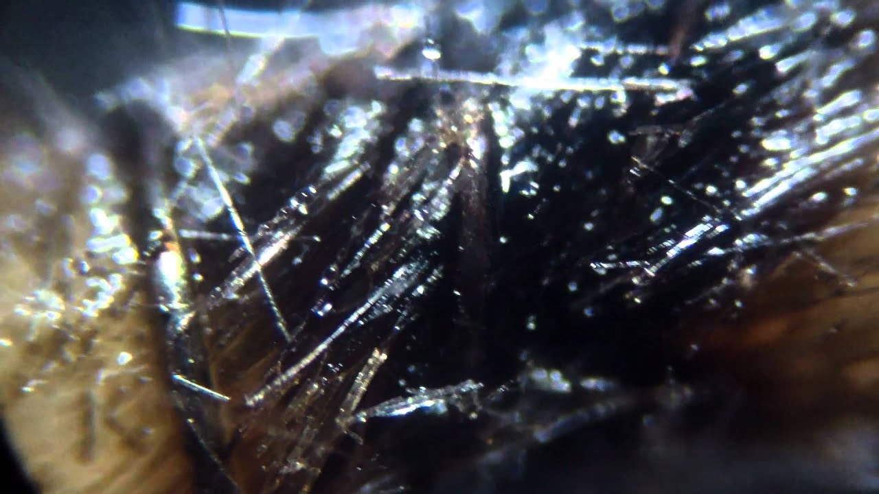 Used silica wick under microscope