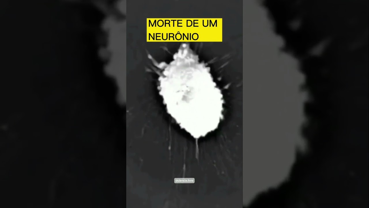 O MOMENTO DA MORTE DE UM NEUR&Ocirc;NIO