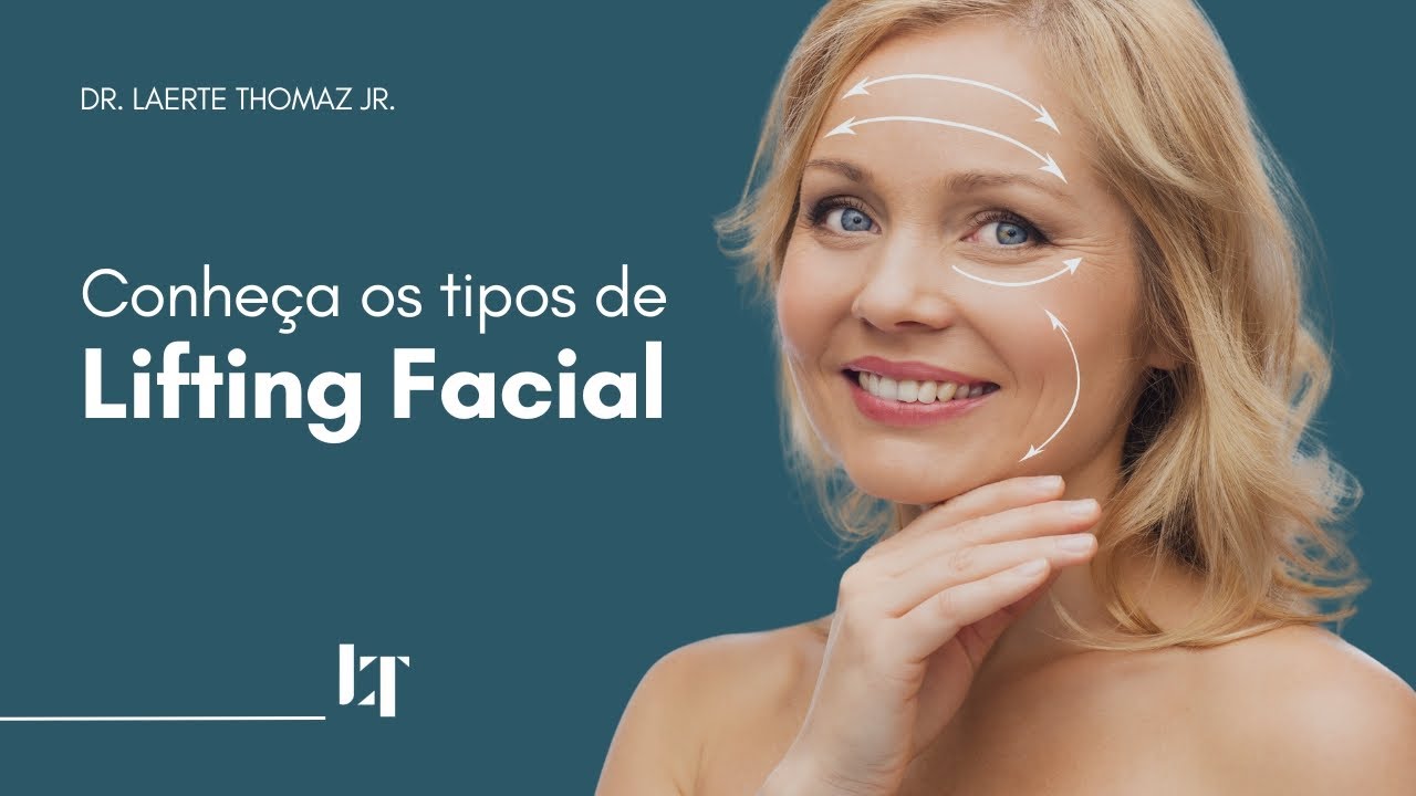 Tipos de Lifting Facial - Dr Laertes