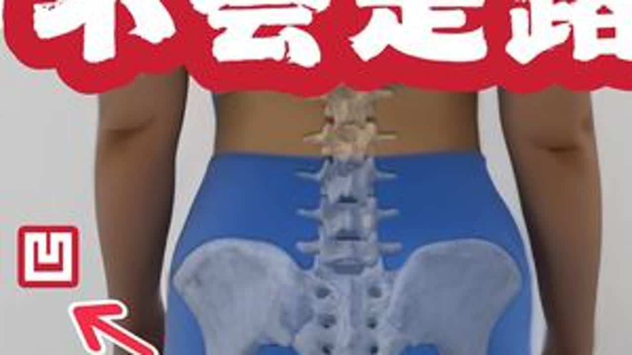 这种臀型学走路姿势也没用，必须恢复功能 #假胯宽 #假胯宽改善 #橘子体态矫正 #走路 #正确走路姿势