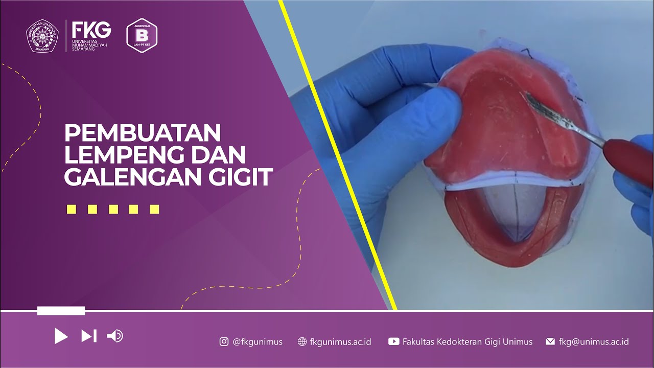 Pembuatan Lempeng dan Galengan Gigit