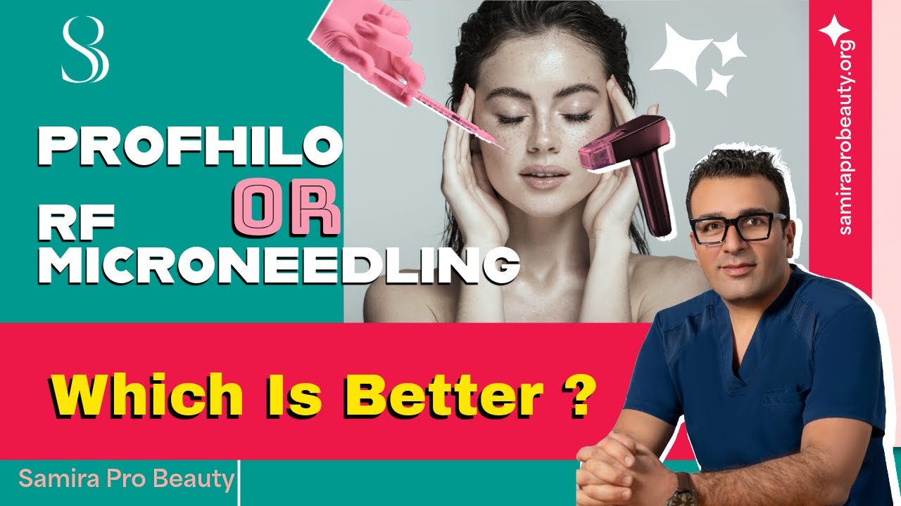 Profhilo or RF Microneedling? Which Is Better for Rejuvenation?