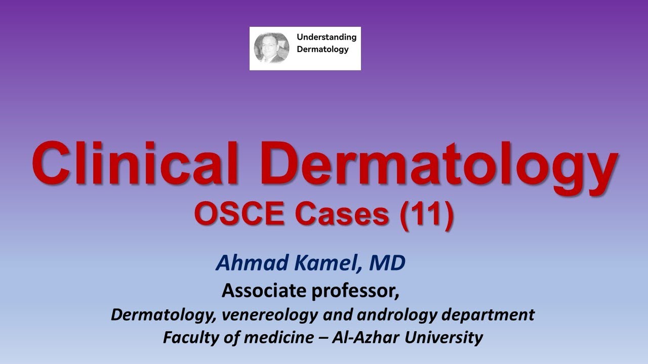 Clinical Dermatology OSCE Cases 11