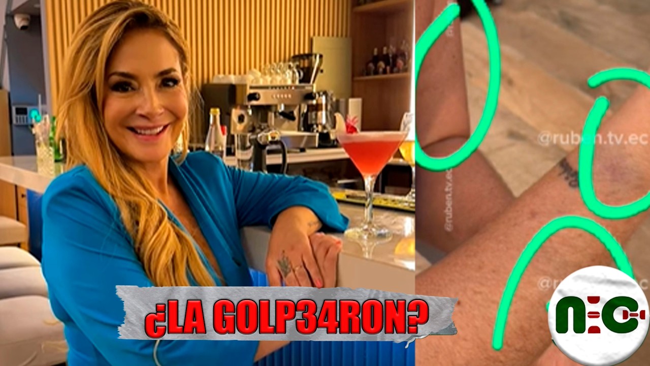 Marián Sabaté aparece con golp35 en su cuerpo