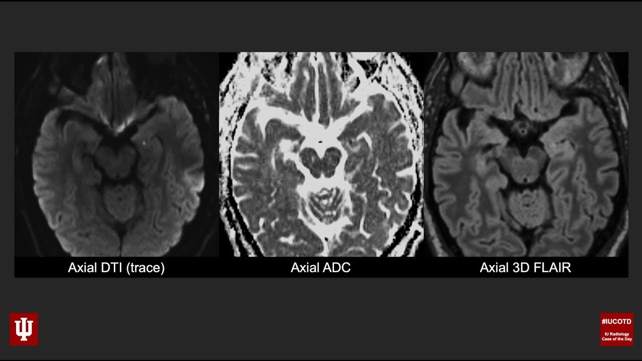 Brain Case of the Day 28