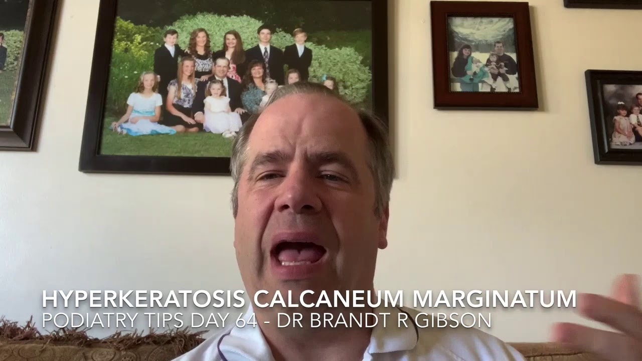Hyperkeratosis Calcaneum Marginatum