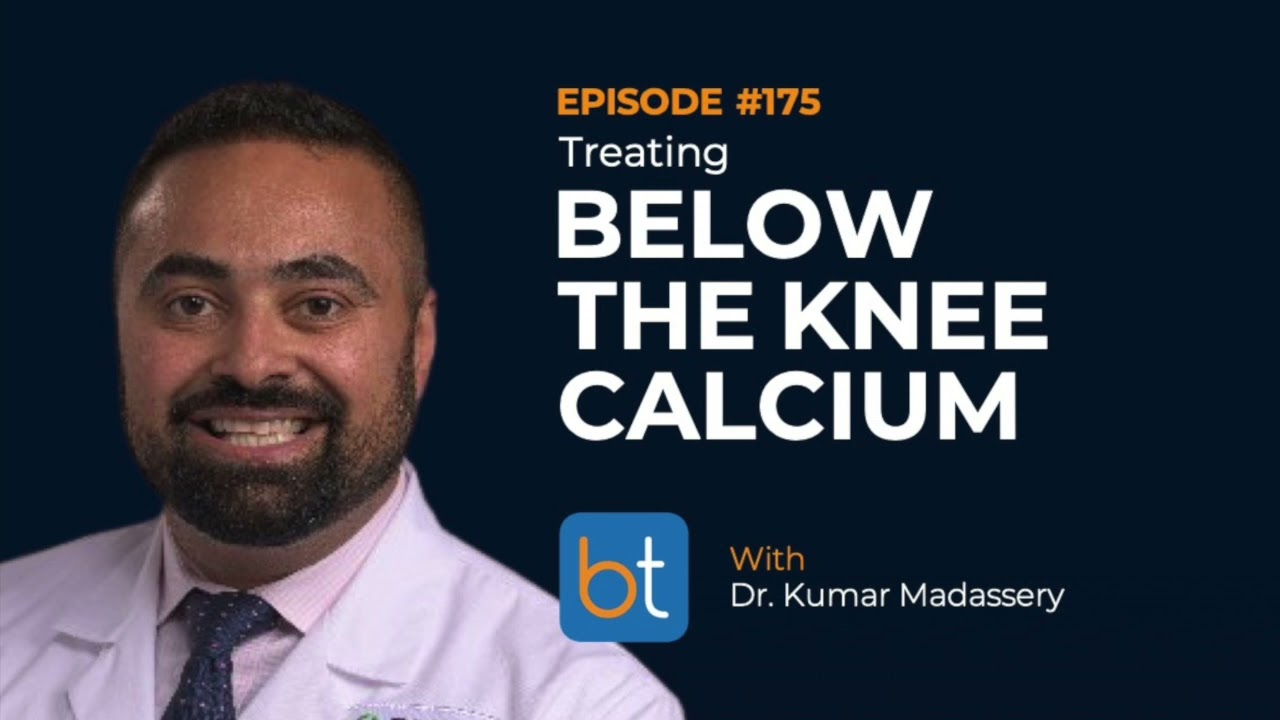 Treating Below the Knee Calcium w/ Dr. Kumar Madassery | BackTable Podcast Ep. 175