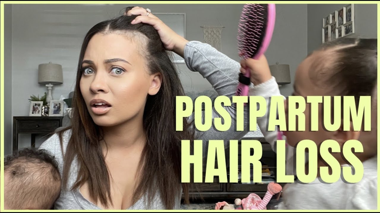 I'M BASICALLY GOING BALD: POSTPARTUM HAIR LOSS | Brittney Gray