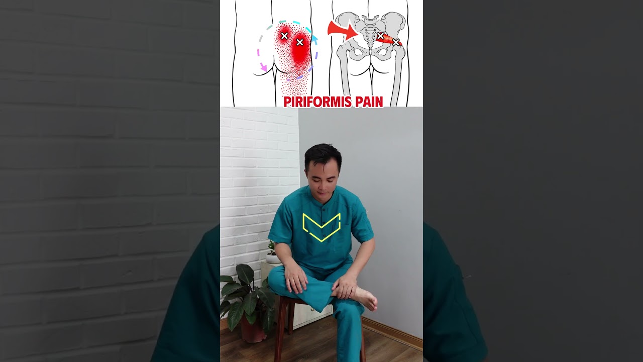 Piriformis Pain Relief Exercise  #physiotherapist #chiropractic