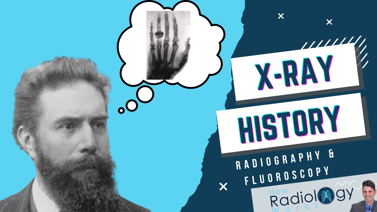 History of X-ray Imaging (Radiography & Fluoroscopy)