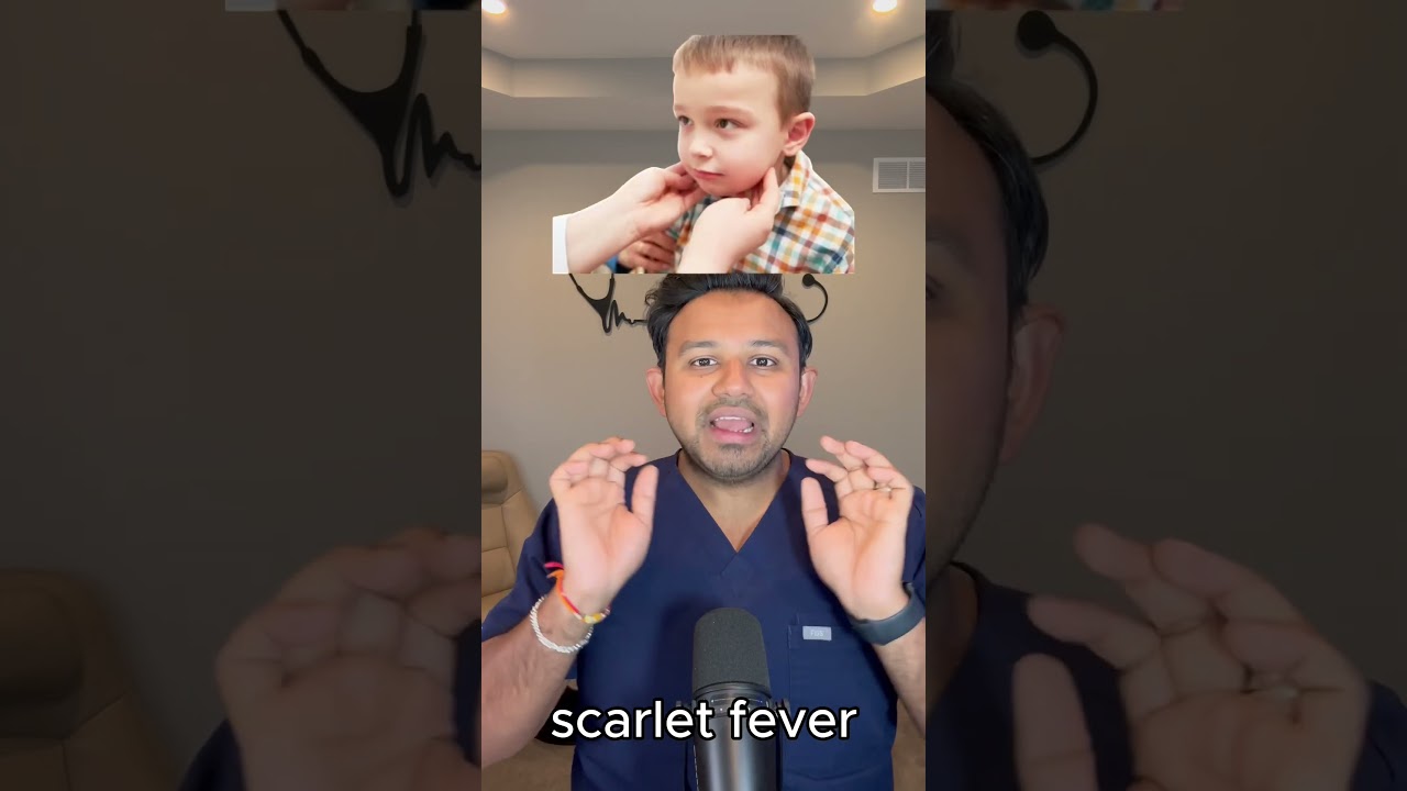 Rheumatic vs Scarlet Fever for the USMLE | HyGuru