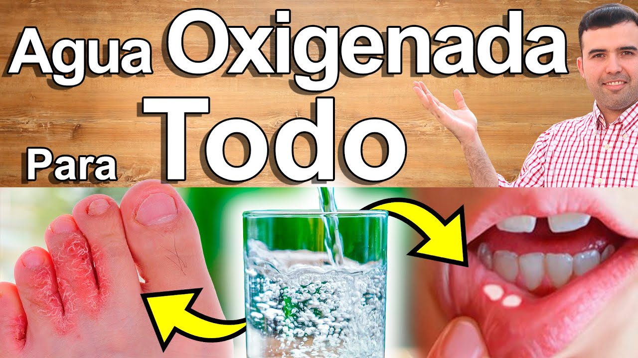 Agua Oxigenada Para Todo - Para Qué Sirve? Beneficios Para La Belleza, Rejuvenecer, Salud Y Más