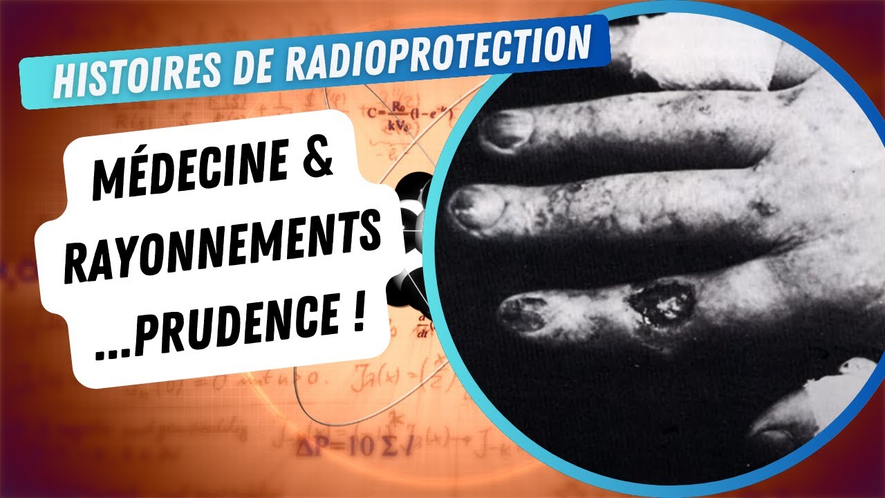 Prudence : Histoire de la radioprotection