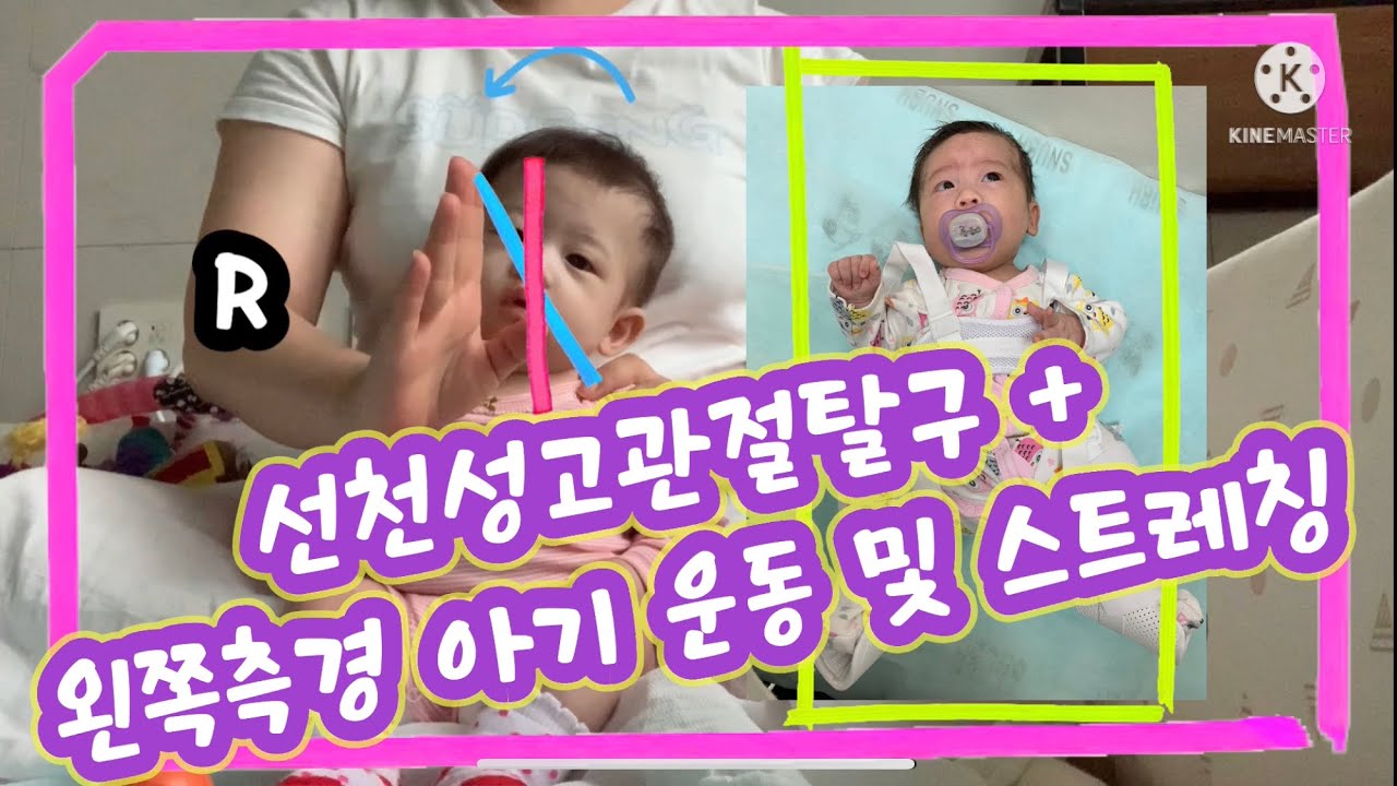 신생아 측경 운동 및 스트레칭 💗(+ 선천성 고관절탈구 부터)