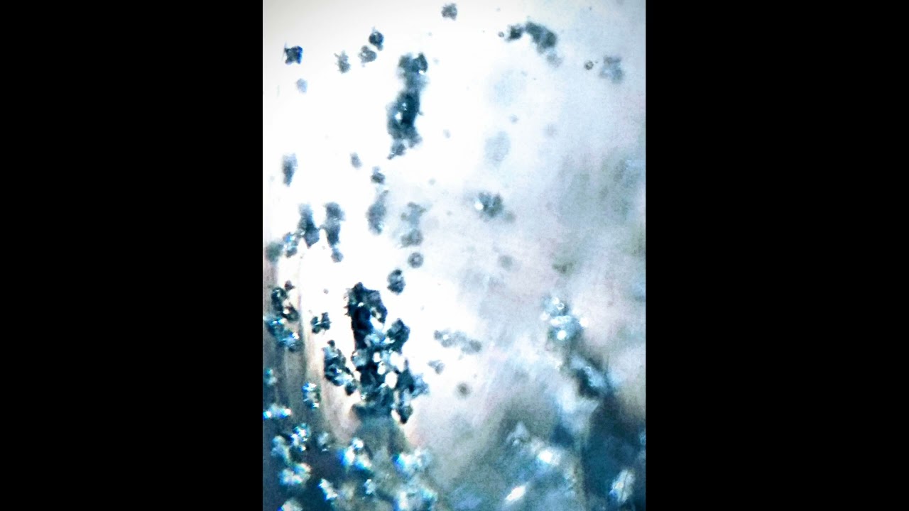 NEUTRALIZING BAD BACTERIA & PARASITES IN THE GUT | MAGNETO-DIELECTRIC (SCALAR) FIELD