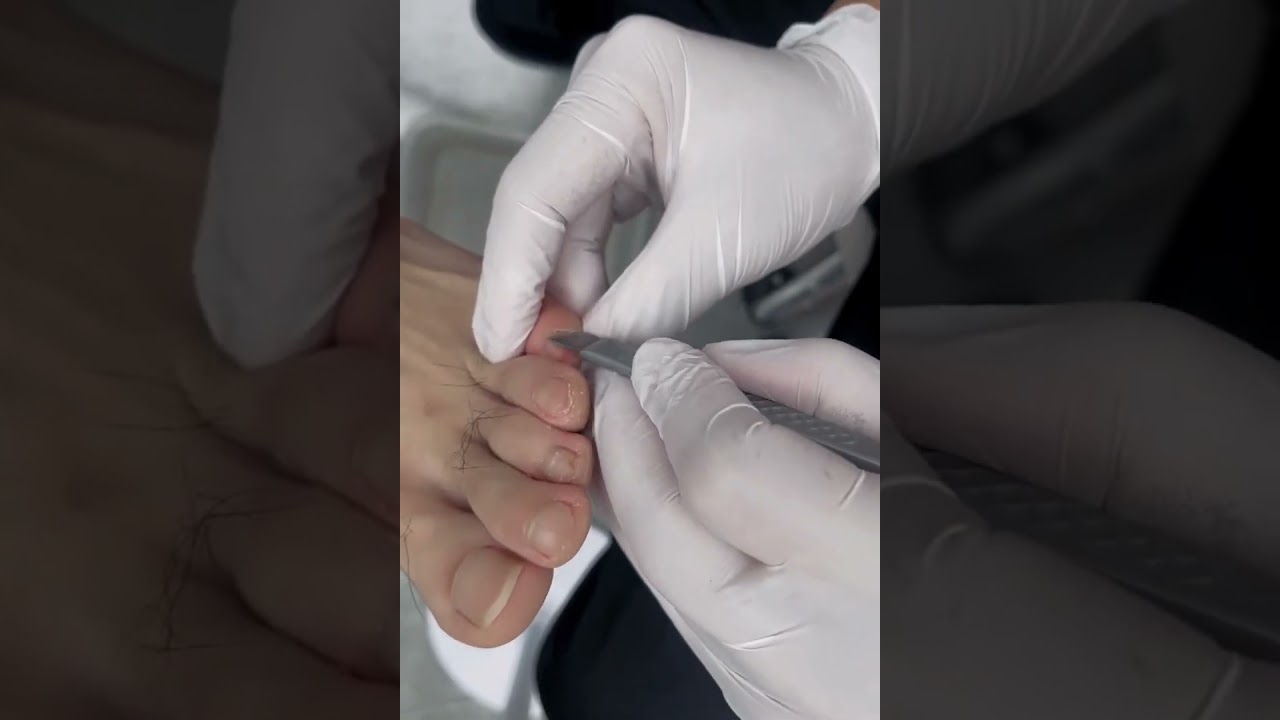 Relaxation and JACK Pedicures Cleaning ASMR #Toenail 