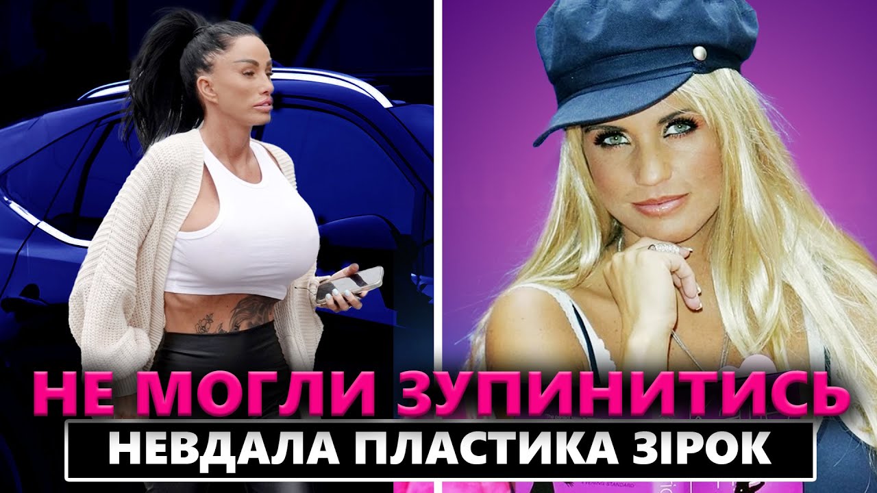 5 ЗІРОК, ЯКІ СЕБЕ СПОТВОРИЛИ в погоні за молодістю і трендами | НЕВДАЛІ ПЛАСТИЧНІ ОПЕРАЦІЇ ЗІРОК