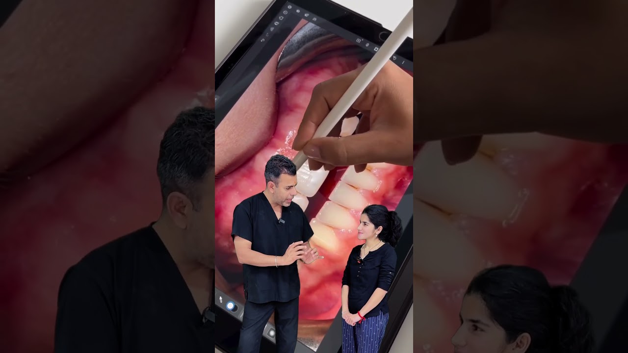 Best Dentist in Delhi for a Smile in a DAY