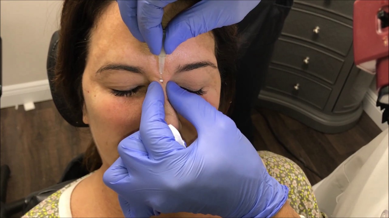 Nose PDO Threads