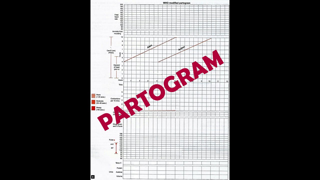PARTOGRAM - INTRODUCTION - CONCEPT AND HOW IT WORKS