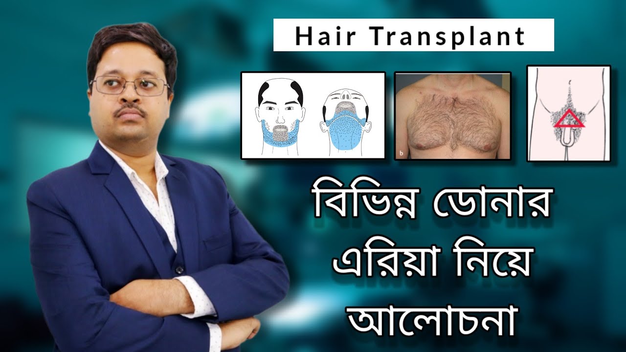 Hair Transplant : বিভিন্ন ডোনার এরিয়া নিয়ে আলোচনা | Dr. Jayanta Bain plastic surgeon