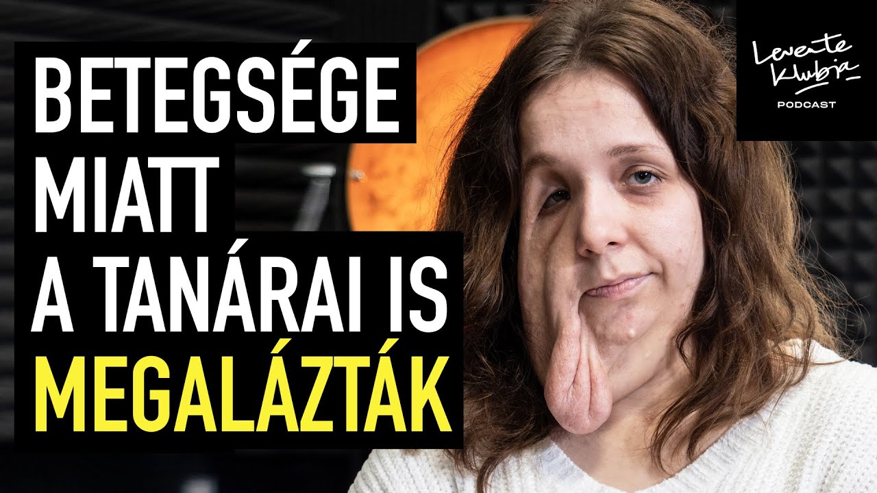 Ismerd meg a ritka, gyógyíthatatlan betegséggel élő Réka történetét! | LEVENTE KLUBJA