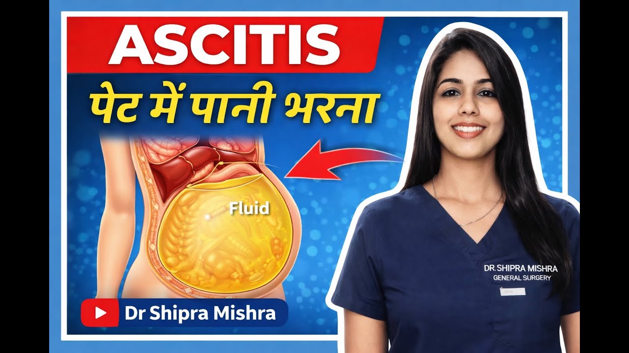 Ascites in hindi | ascites treatment | Ascites examination |
