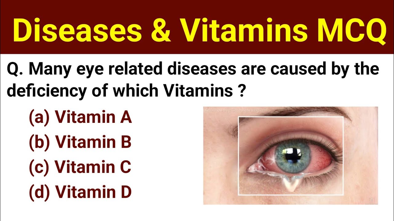 Diseases & Vitamins Important MCQ Questions | General Science Important Questions MCQ For All Exams
