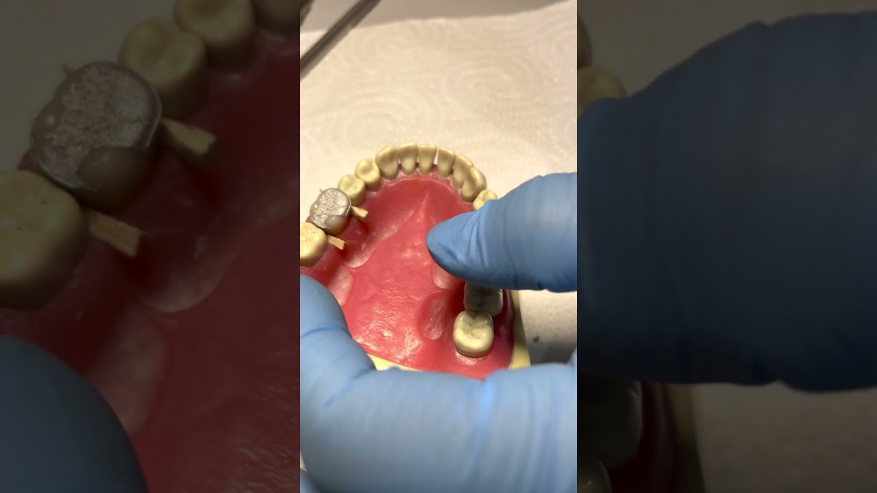 ADC exam amalgam task part 4