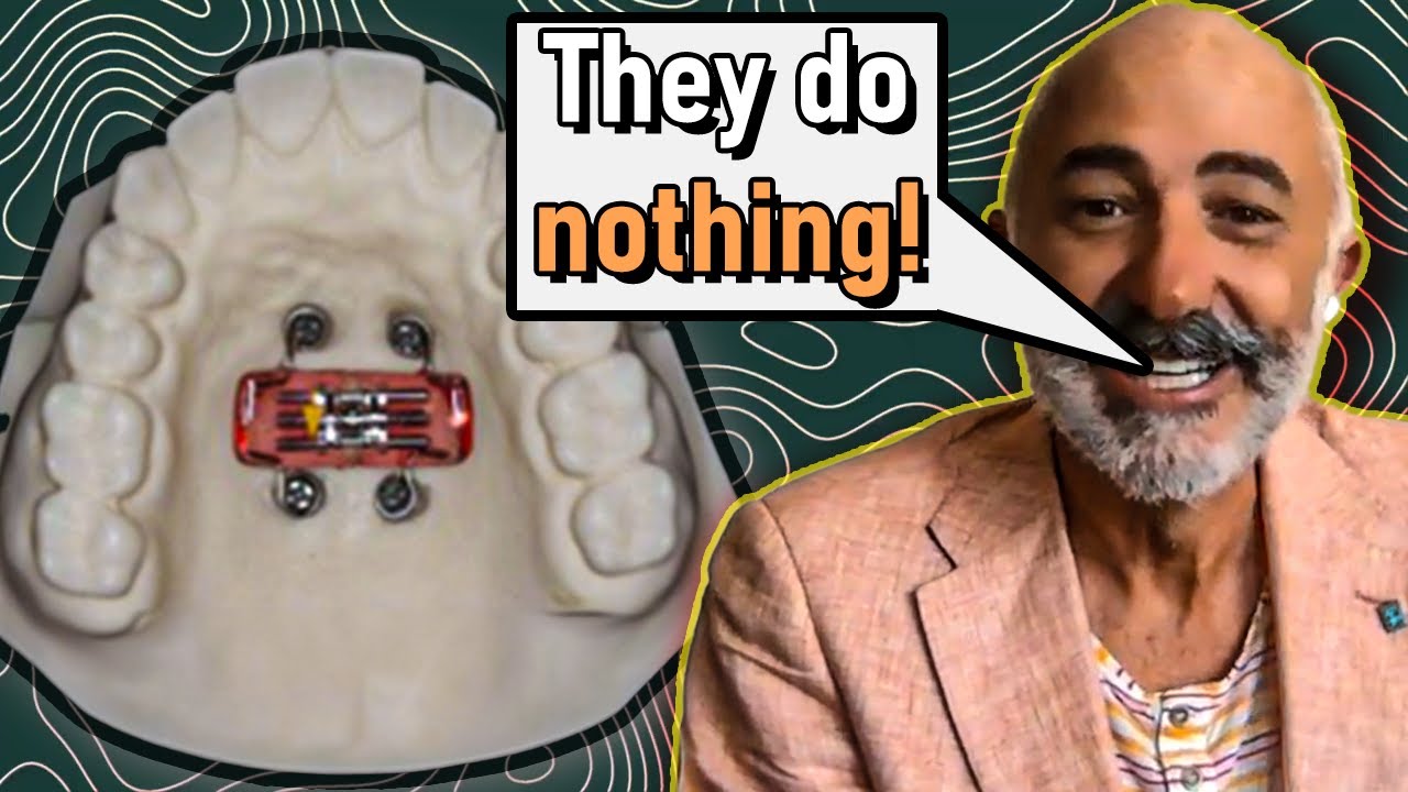 Dr. Coceancig's Opinion on Skeletal Expanders (MSE, MARPE, EASE)