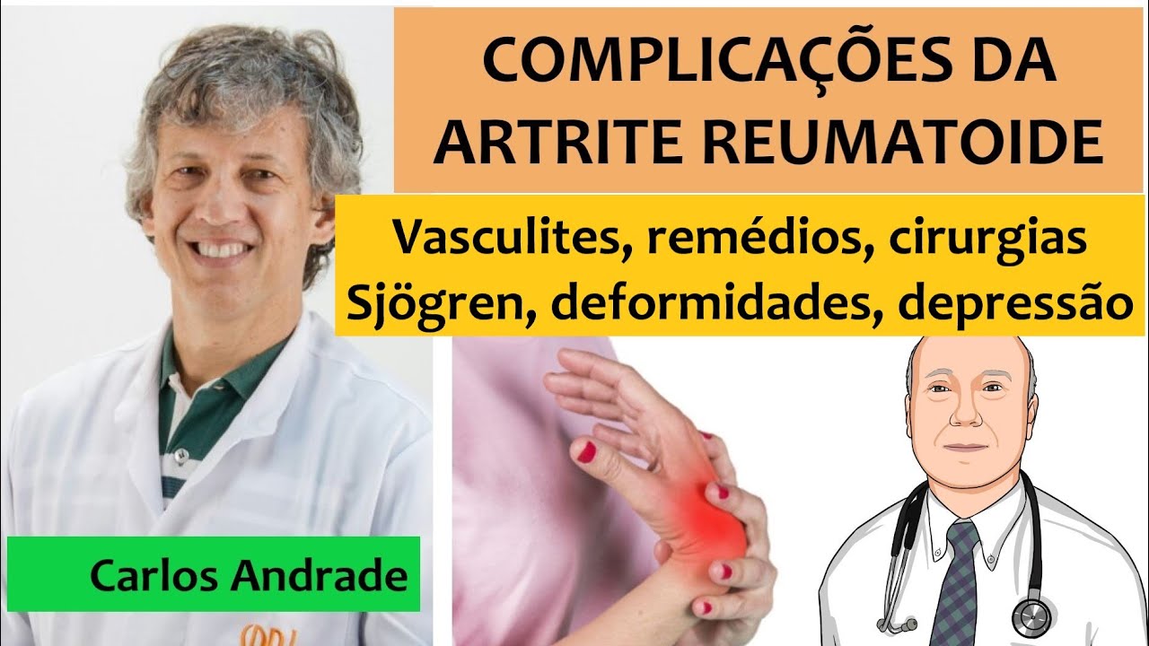 Os segredos para evitar e resolver complicações da artrite reumatoide.