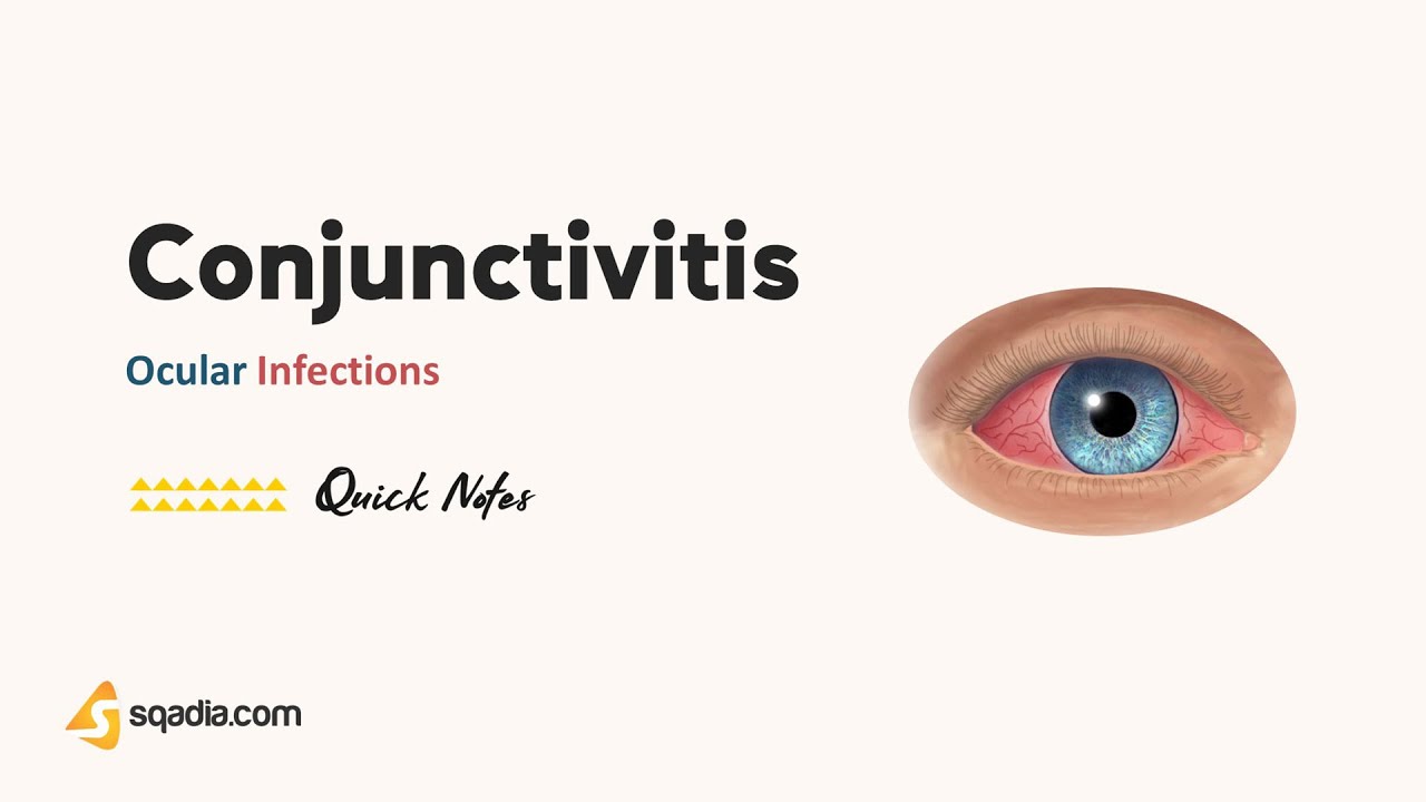 Ocular Infections | Conjunctivitis