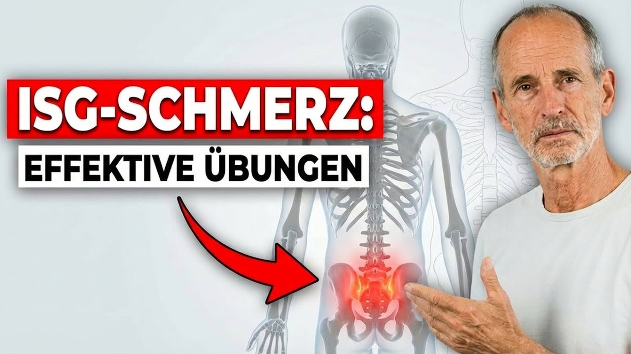 ISG Schmerzen: Ursachen & was du tun kannst