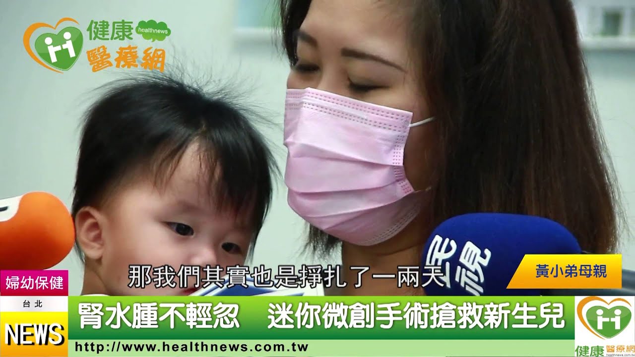 腎水腫不輕忽   迷你微創手術搶救新生兒