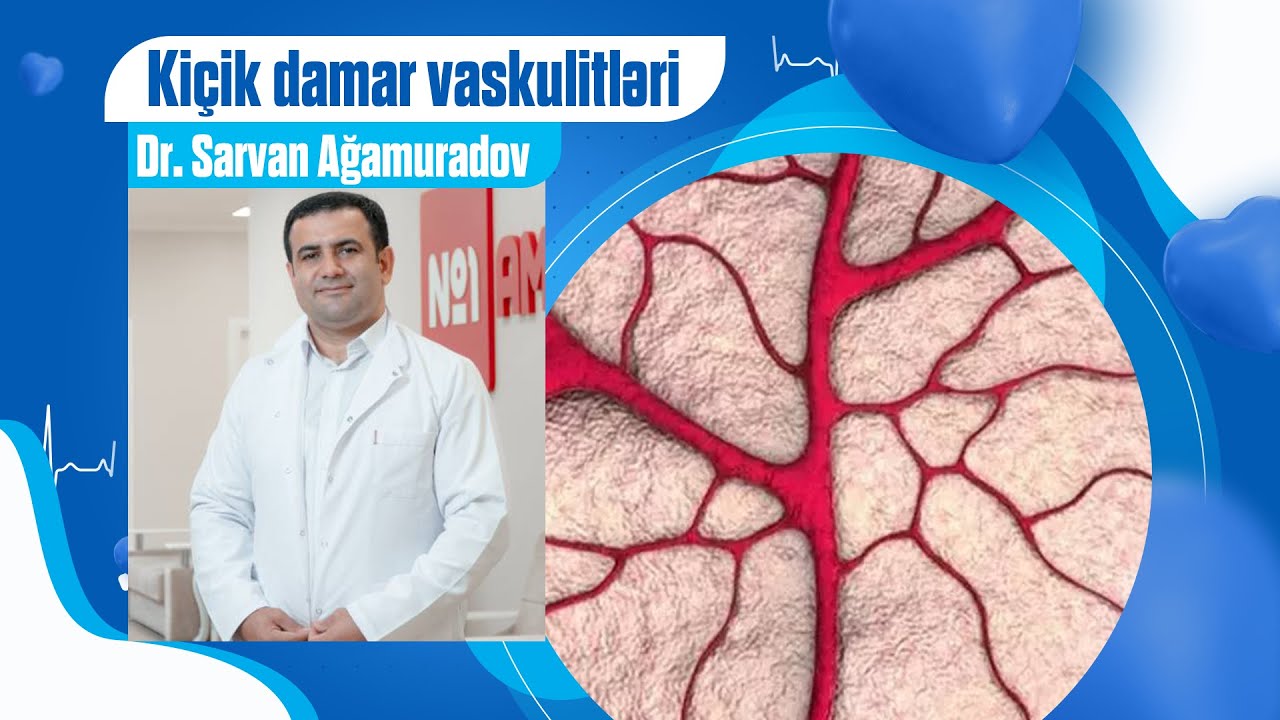 Kiçik damar vaskulitlərinə hansı revmatik xəstəliklər aiddir?