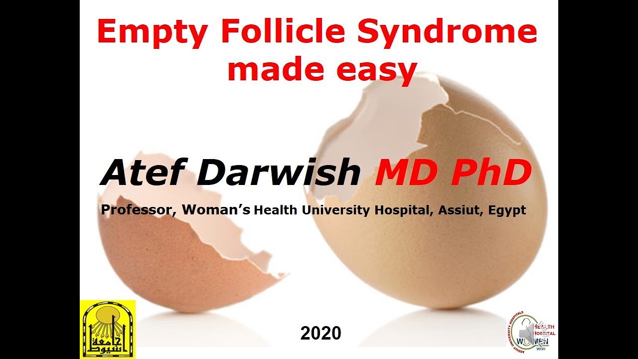 Empty Follicle Syndrome made easy.