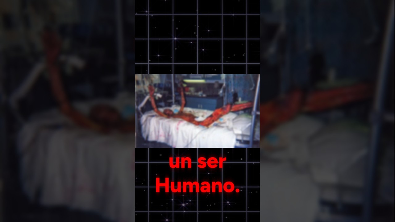 EL EXPERIMENTO M&Aacute;S CRUEL DE LA CIENCIA | Caso Hisashi Ouchi