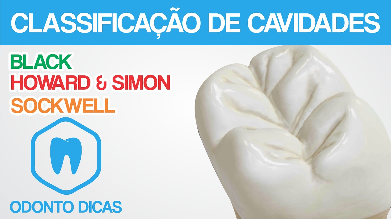 CLASSIFICAÇÃO DE CAVIDADES | ODONTO DICAS