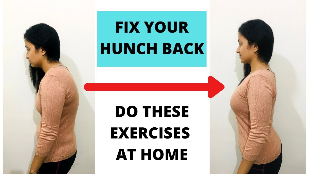 HOW TO FIX HUNCH BACK | HINDI