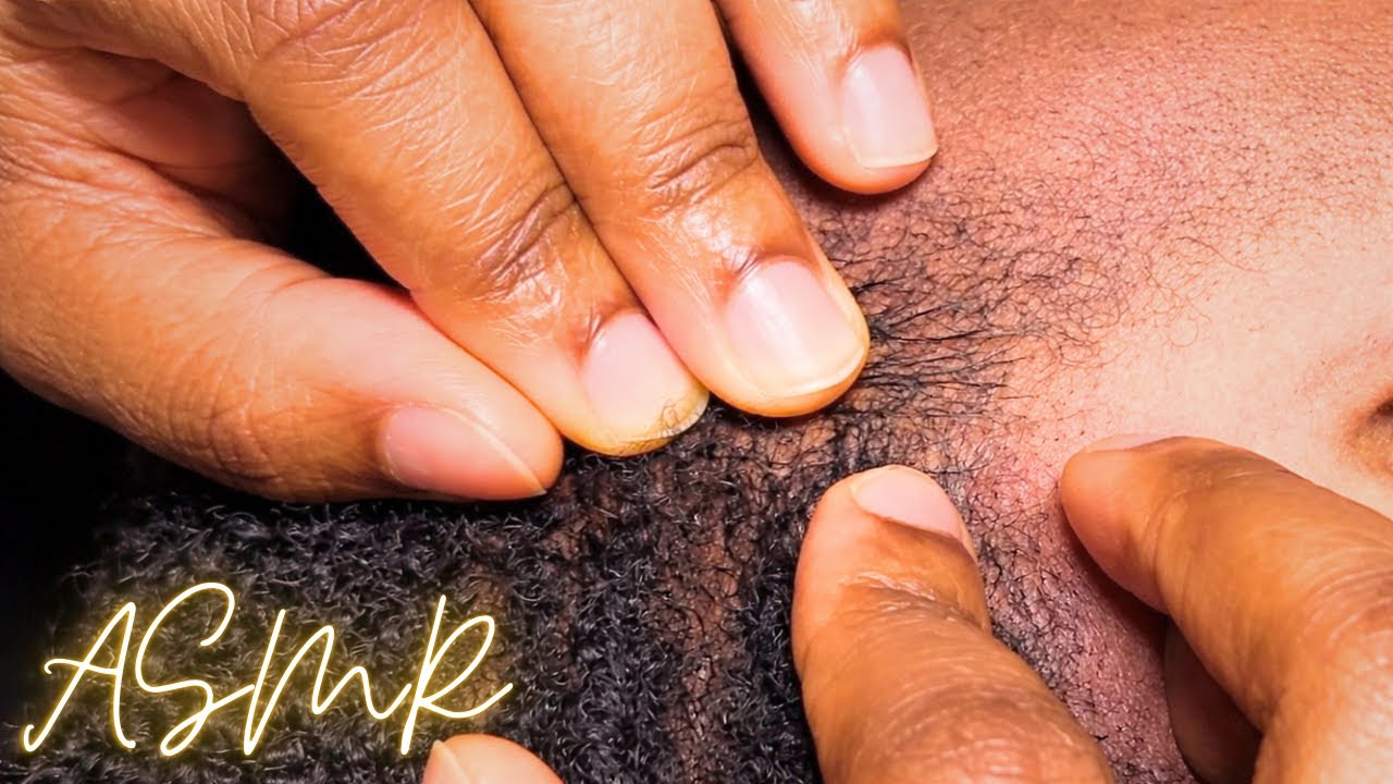 Extreme Scalp Nitpicking ASMR for Deep Sleep | Close Up Scalp Check