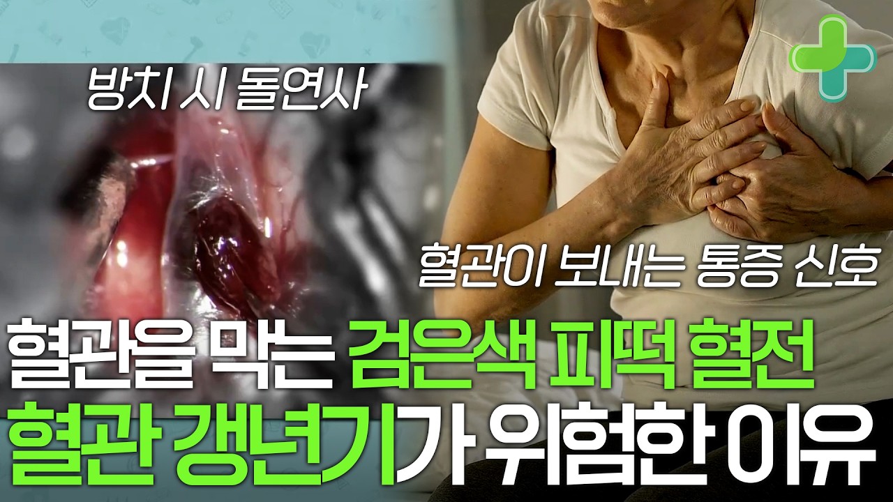 완치 비율 단 9% 생명을 위협하고 심각한 뇌 손상을 초래하는 혈전