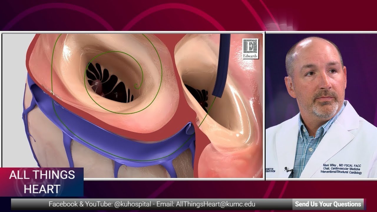 Encore - All Things Heart - “Alt Flow” for Heart Failure