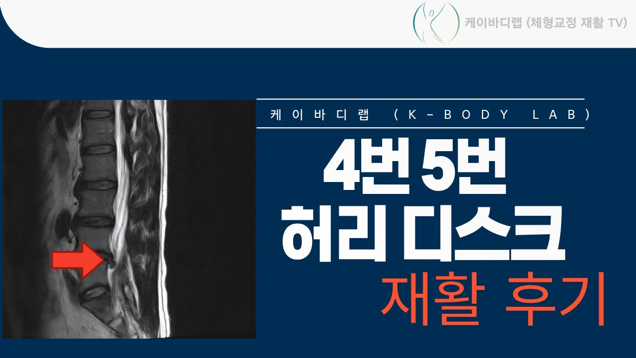 4화 4번 5번 허리디스크 재활 후기