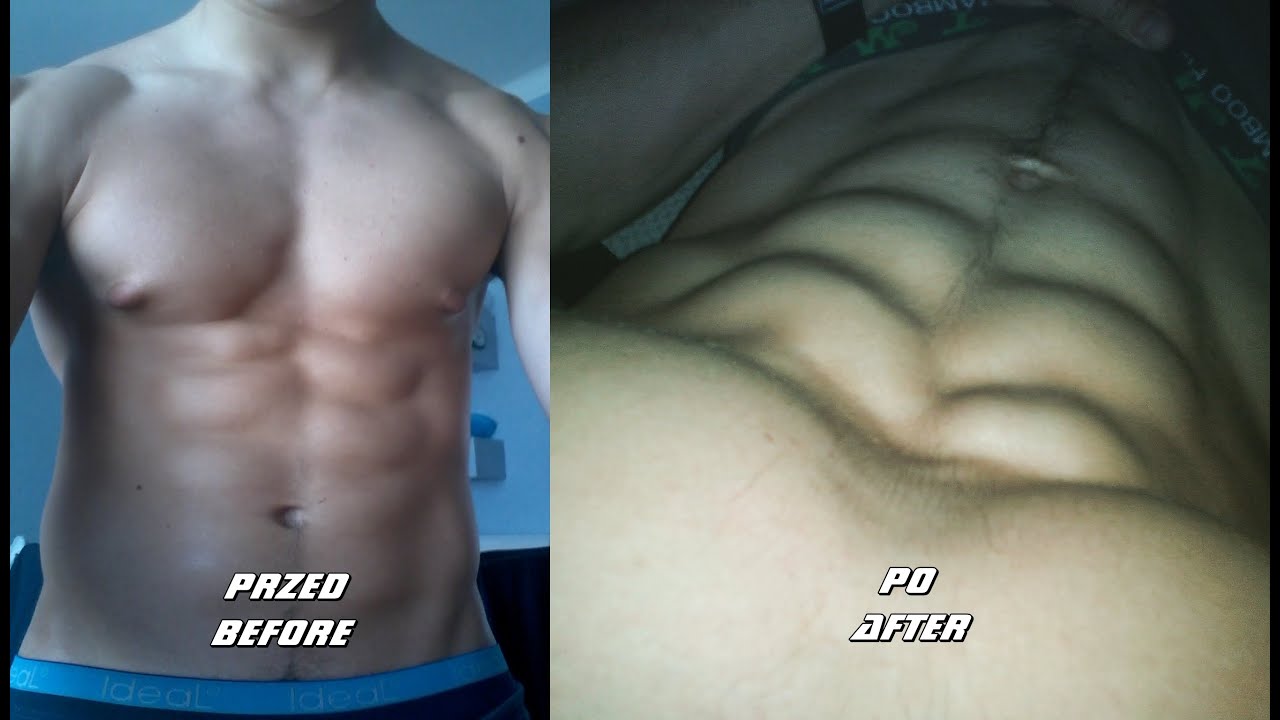JAK WZMOCNIĆ I WYRZEŹBIĆ BRZUCH (ĆWICZENIA) - KURA WORKOUT