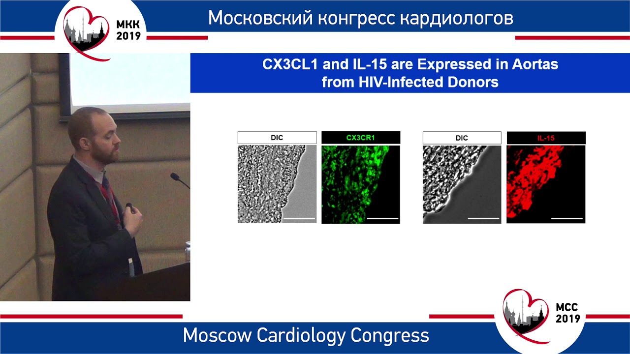 М. Фриман. Взаимодействие CD8 T-клеток и эндотелия стимулирует атерогенез.