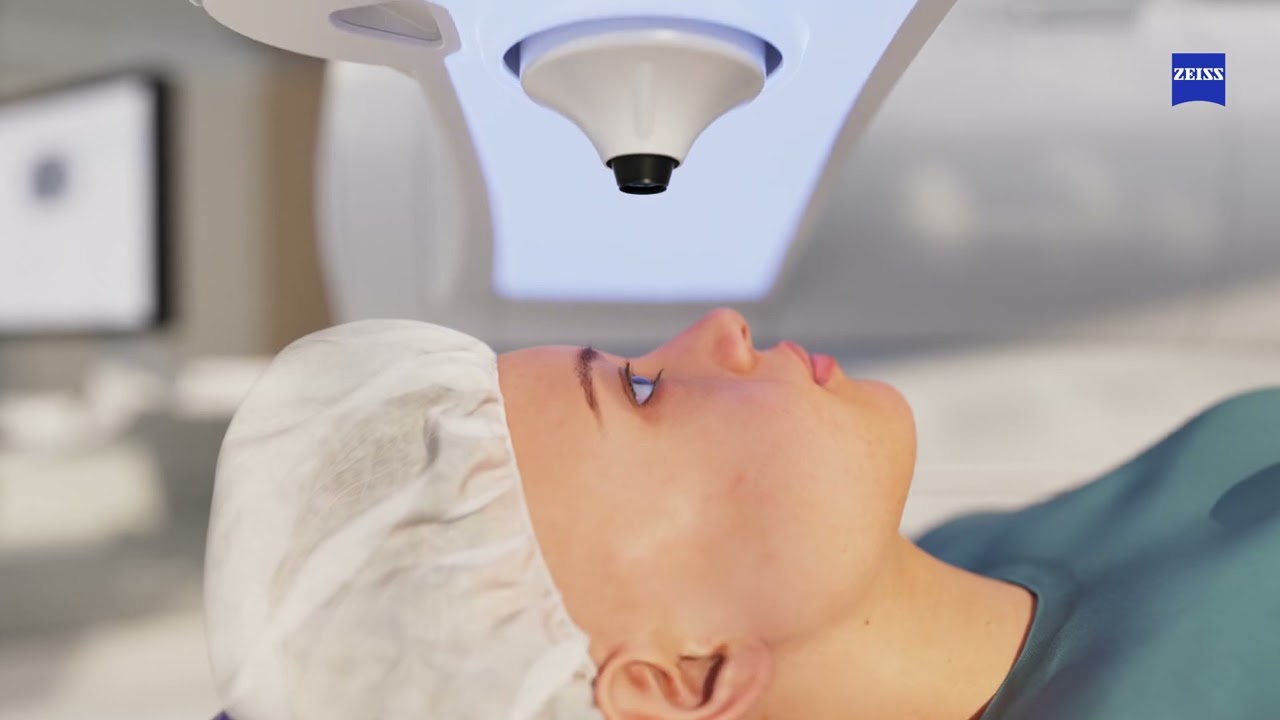 Descubra SMILE Pro de ZEISS: La Revolución en Cirugía Ocular