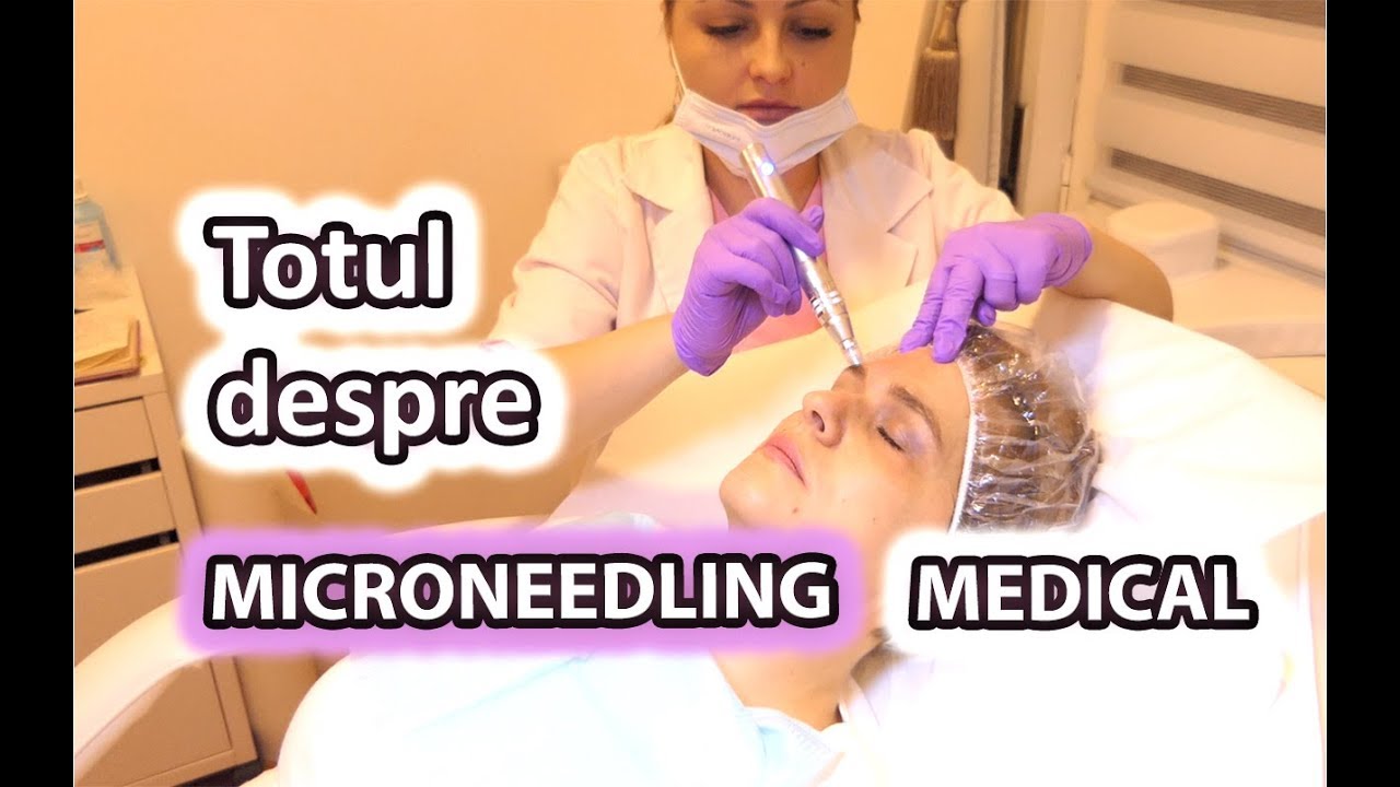 Microneedling Medical | Mezoterapia Fractionata