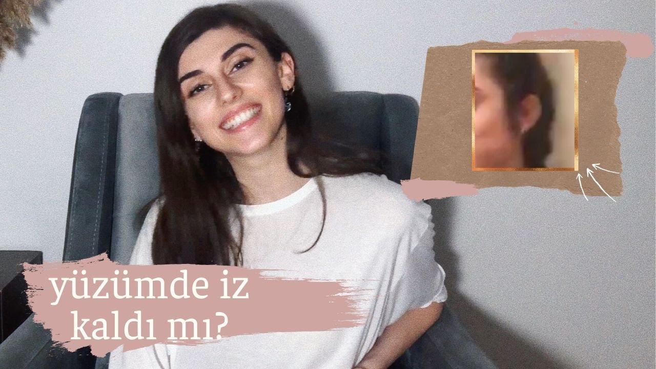 İğneli Epilasyon Sürecim I Tüm Detaylarıyla